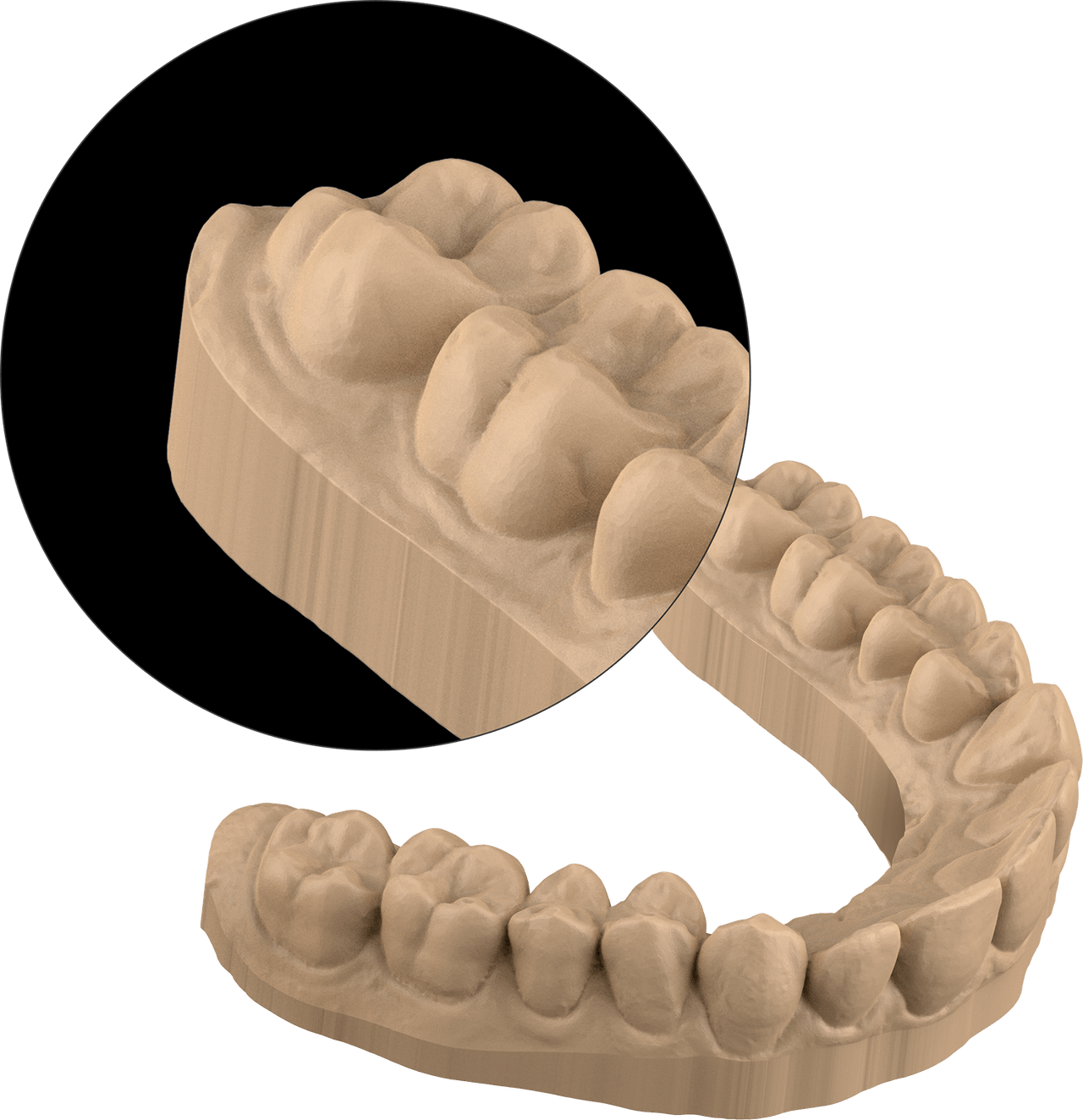 downey invisalign