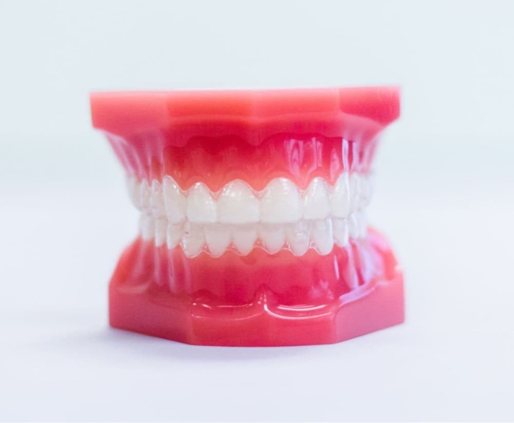 invisalign aligners on plastic model