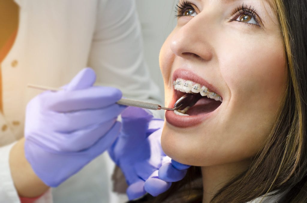 Dentist vs. Orthodontist for Braces | Brodsky Orthodontics