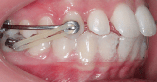 vxksxIVm orthodontist long beach