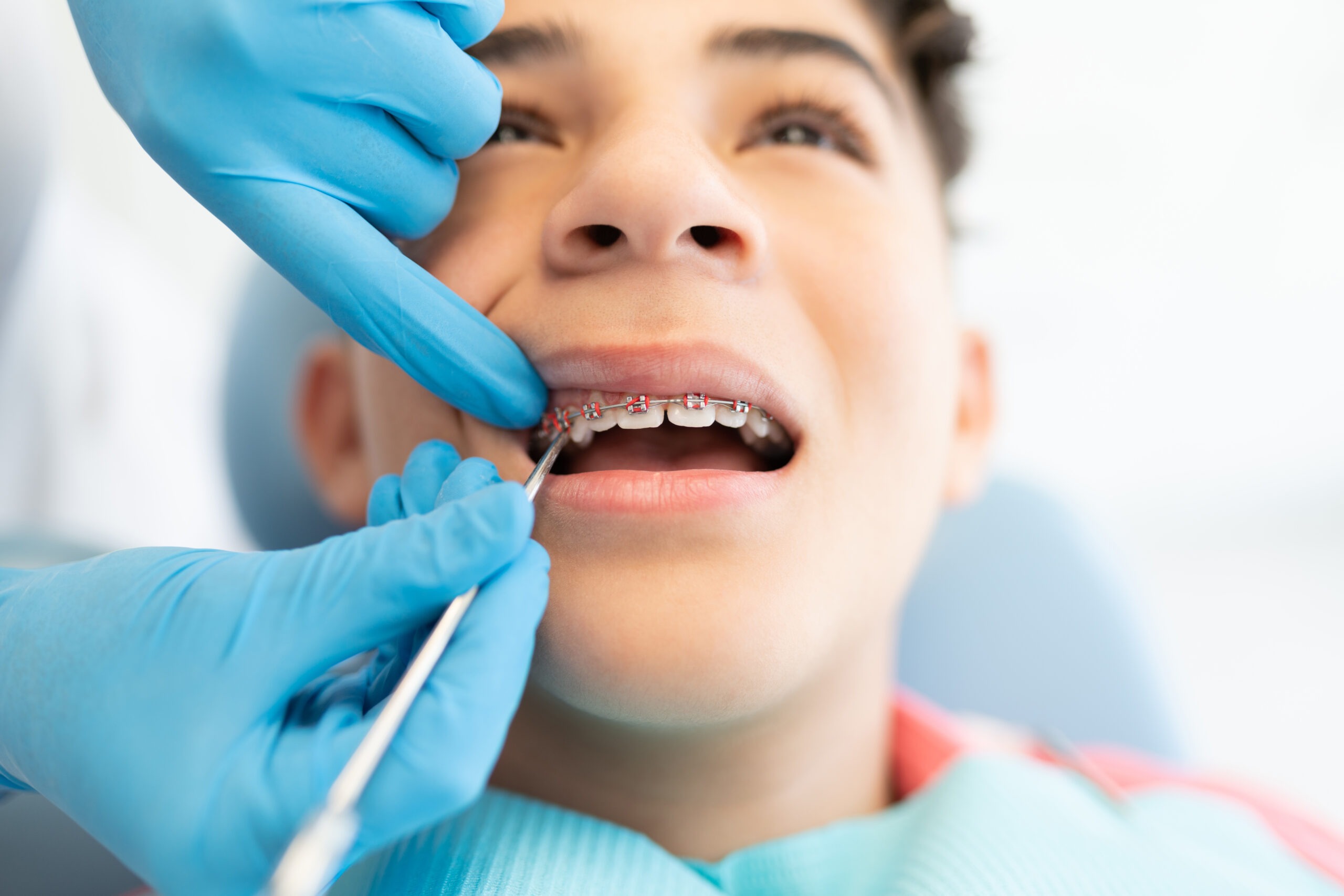 Additional Orthodontic Treatment With Braces