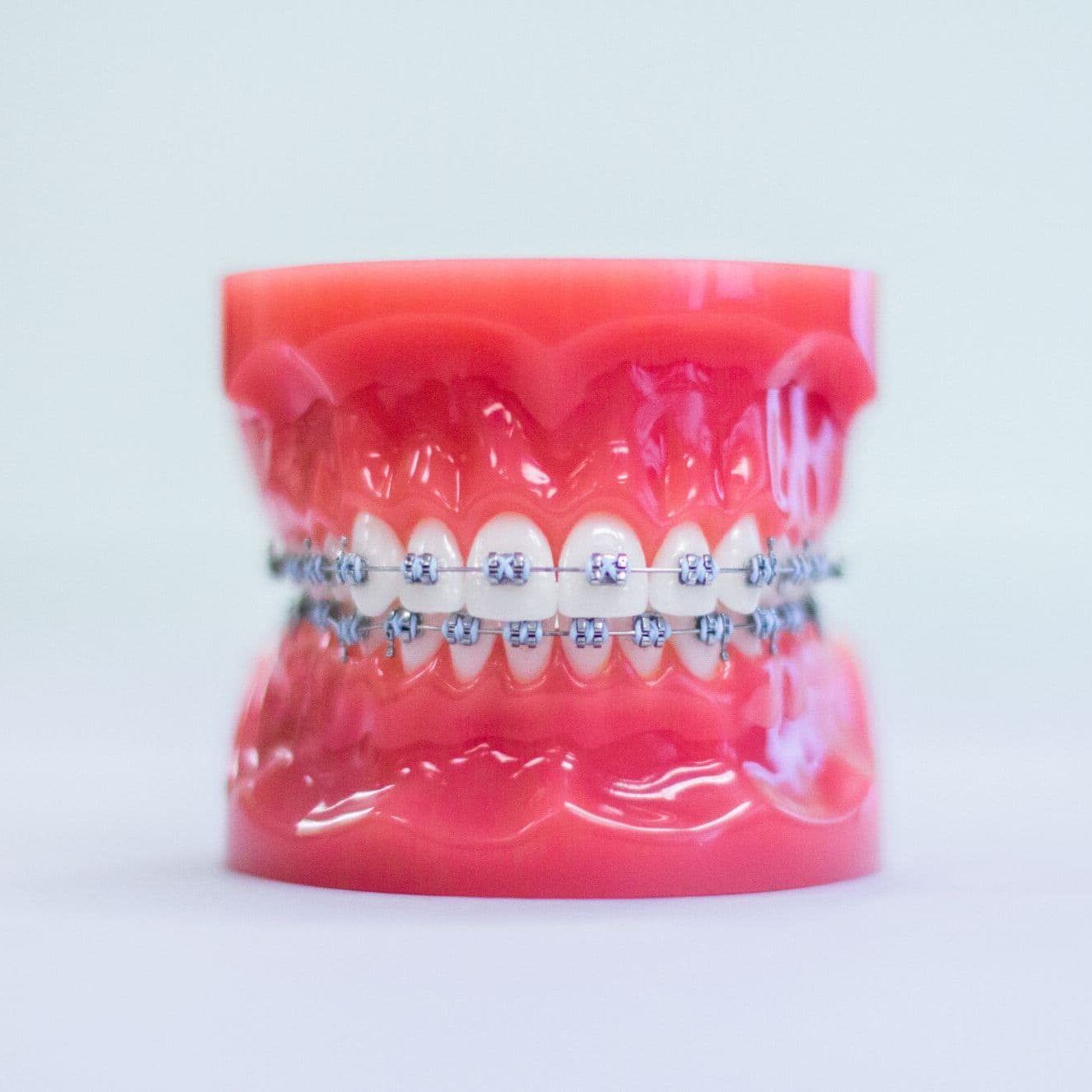 downey invisalign